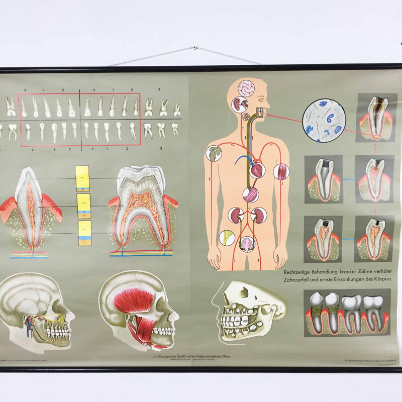 Vintage educational poster on teeth by Jung-Koch Quentell, 1960