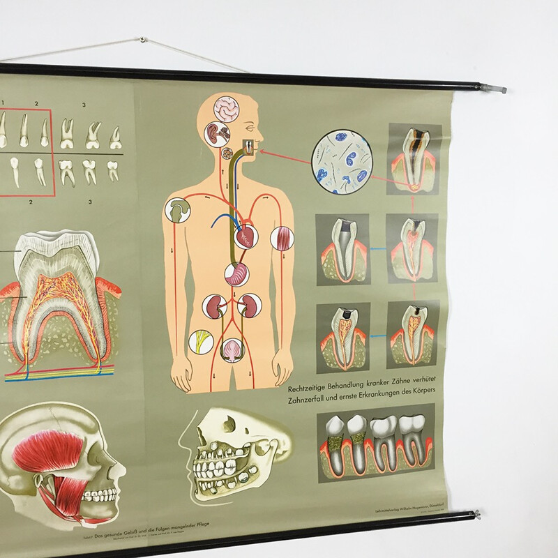 Vintage educational poster on teeth by Jung-Koch Quentell, 1960