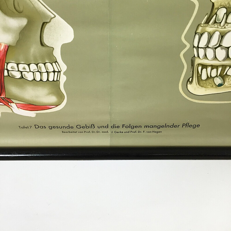 Grande affiche éducative vintage sur les dents, Jung-Koch QUENTELL - 1960